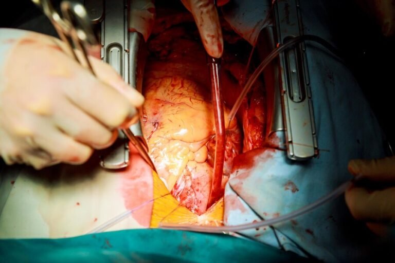 A Closer Look At Laparoscopic Hernia Surgery