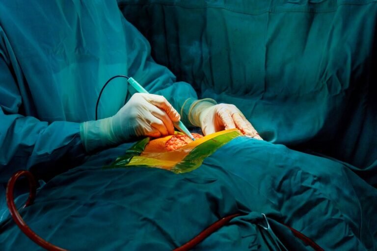 Mastering Laparoscopic Cholecystectomy: Surgeon’s Perspective